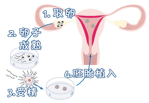 关于丹韵生殖